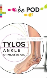 FH ORTHOPEDICS be POD TYLOS Arthrodese-Nail Manual