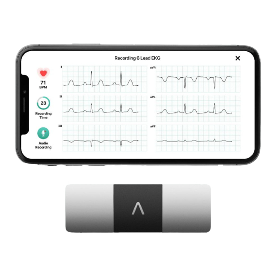 AliveCor Kardia Gebrauchsanweisung